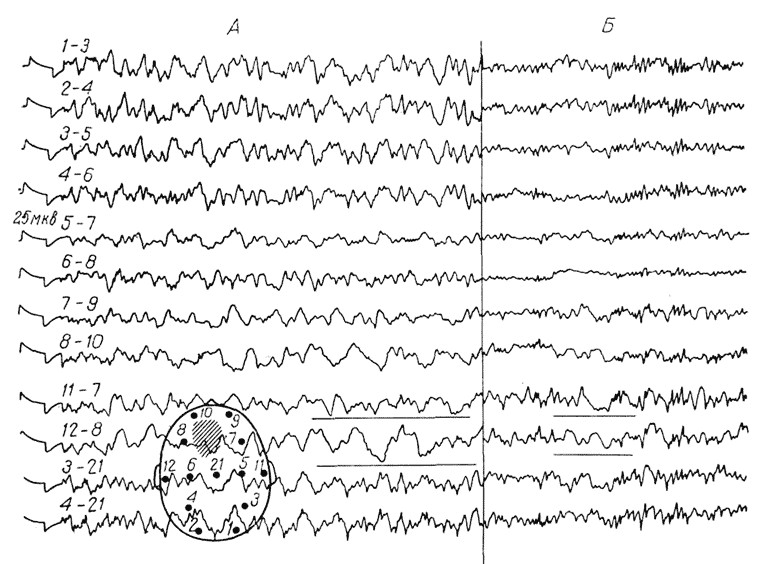 Чем отличаются "нейро-" и "когно-" подходы?